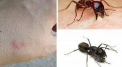 Mravence kousnutí a jeho důsledky